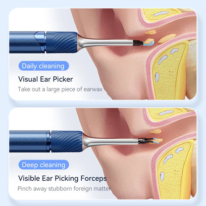 Smart Ear Cleaner with Camera, Ear Stick, USB-C Charging, Earwax Removal Tool,  6 LED Lights, Ear Scoop with Tweezers