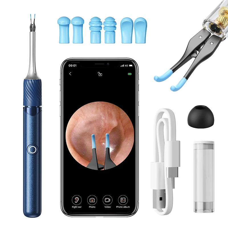 Smart Ear Cleaner with Camera, Ear Stick, USB-C Charging, Earwax Removal Tool,  6 LED Lights, Ear Scoop with Tweezers