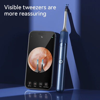 Smart Ear Cleaner with Camera, Ear Stick, USB-C Charging, Earwax Removal Tool,  6 LED Lights, Ear Scoop with Tweezers